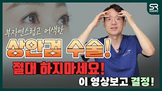 눈꺼풀처짐 개선하는 상안검수술이란?