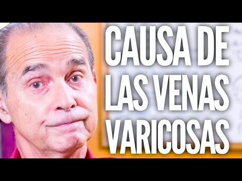 Episodio #1943 Causa De Las Venas Varicosas