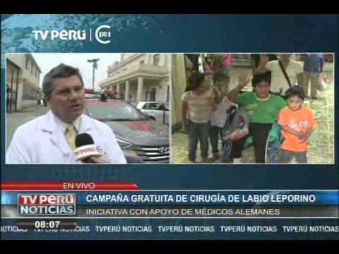Campaña gratuita de cirugía de Labio Leporino