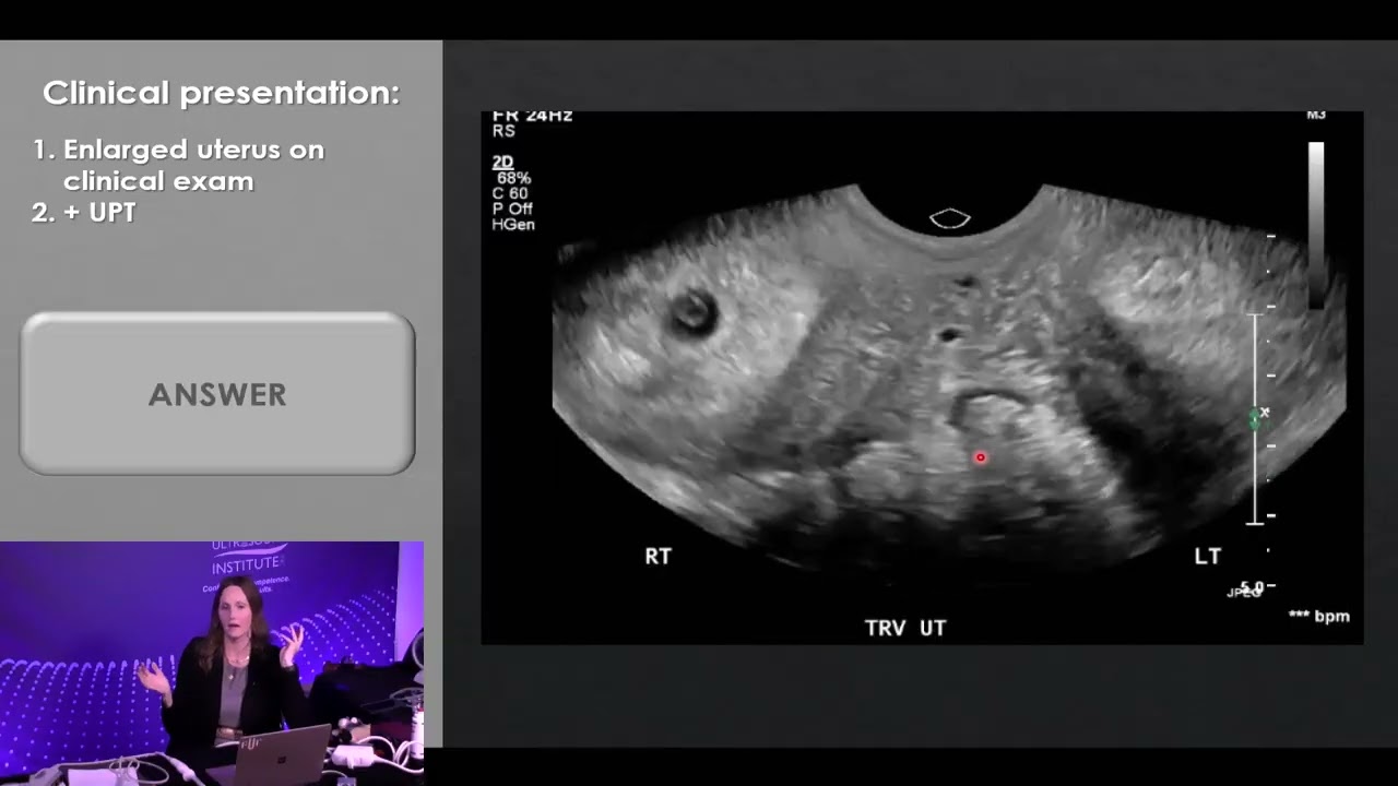 OB Case Review for POCUS-SAMPLE