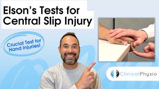 Elson’s Test Explained | Central Slip Injury & Reverse Elson’s (Physio)