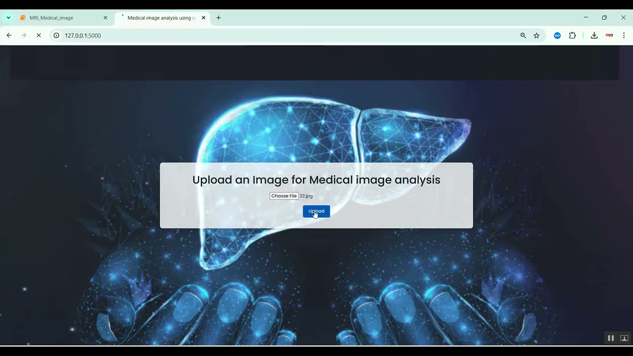 Liver Segmentation using Unet Medical Image Analysis in Python Projects