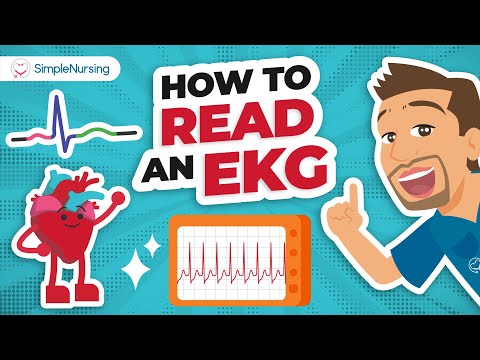 How to Read an EKG Strip