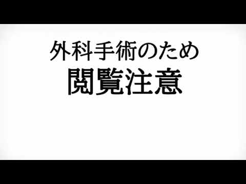 ガミースマイル治療