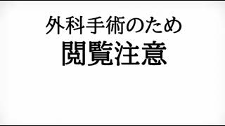 ガミースマイル治療 動画