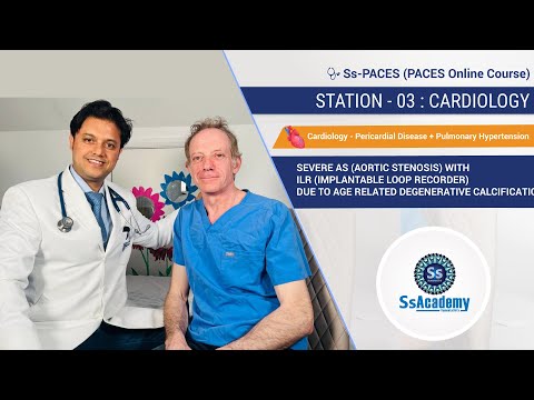 PACES 2023 New Format |Ss-PACES|Sample|Station-3|SEVERE AORTIC STENOSIS with ILR due to DC