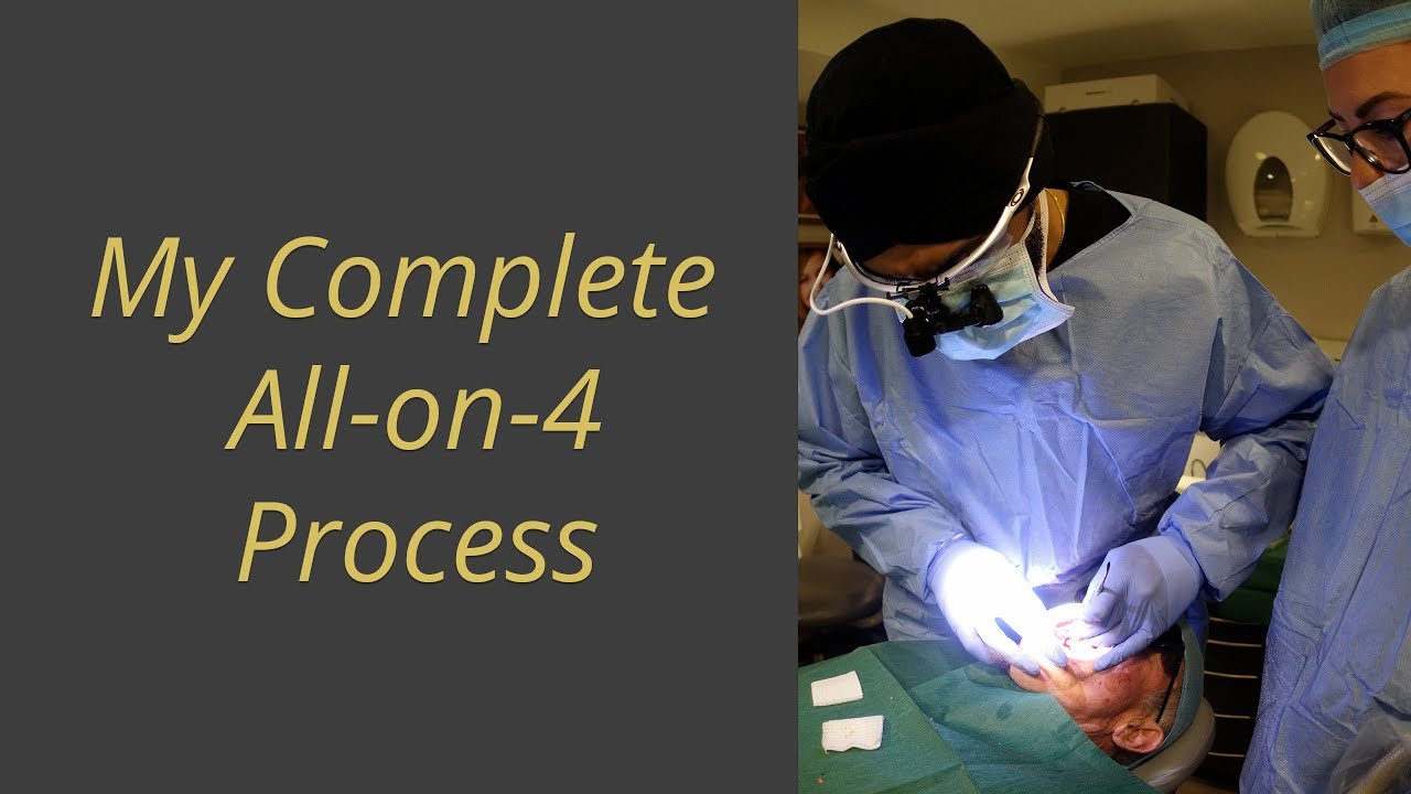 All on 4 - What to Expect