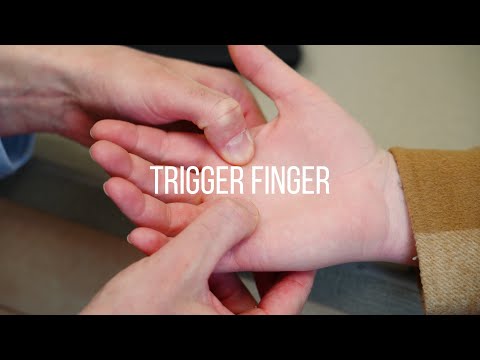 Trigger Finger Symptoms, Causes, and Treatment