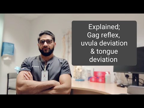 Explained; Uvula & tongue deviation