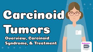Carcinoid Tumors - Overview, Carcinoid Syndrome & Treatment