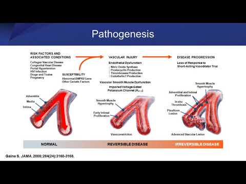Vese artériás hipertónia: tünetek és kezelés - Nefrogén hipertónia kód 10