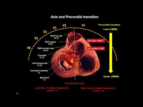 Expert Perspective with Andres Enriquez, MD: Predicting Ventricular Arrhythmias with 12-Lead ECG