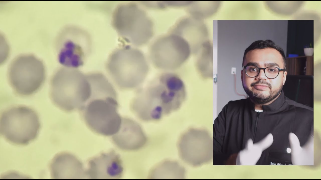 Como é feito o diagnóstico de malária? Como visualizamos plasmodium na lâmina? Aula prática top!