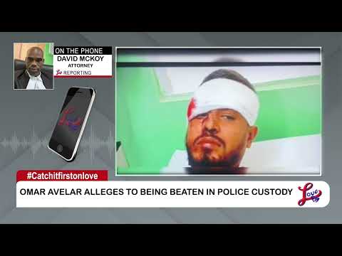 Belmopan Man Hospitalized After Alleged Police Brutality Following Traffic Incident