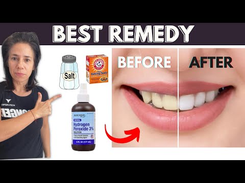 #1 Remedy for YELLOW Teeth (Cats and Dogs Too)!!