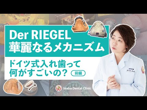 Der RIEGEL 華麗なるメカニズム〜ドイツ式入れ歯って何がすごいの？〜＜前編＞