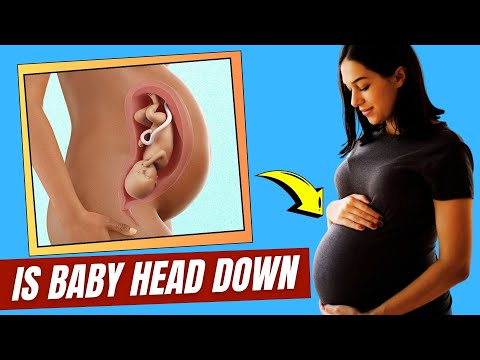 🤰 How to Tell If Your Baby Is HEAD DOWN – 5 Clear Signs