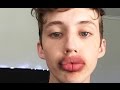 KYLIE JENNER LIP CHALLENGE GONE WRONG