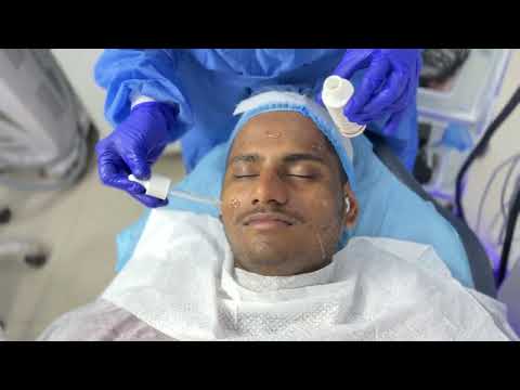 Hydra Dermabrasion Machine