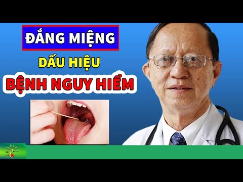 , title : 'Đắng miệng Dấu Hiệu bệnh nguy hiểm cần thăm khám sớm | Sống Khỏe Sống Tốt'