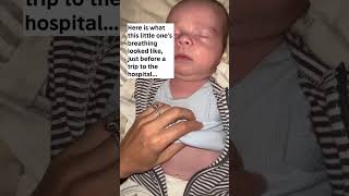 Download lagu Breathing Distress Tip mp3 Download lagu Breathing Distress Tip mp3