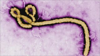 Health Check: What to know about monkeypox