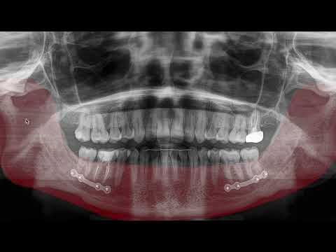Michael Schmitz-11