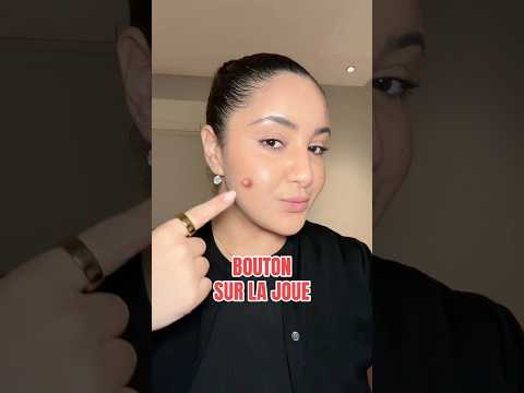 1 bouton = 1 zone du visage = 1 cause #acne #bouton #skincare