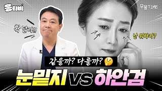 [무.물] 같을까? 다를까? 눈밑지 vs 하안검｜1%성형외과  #김종구 #코수술 #코재수술