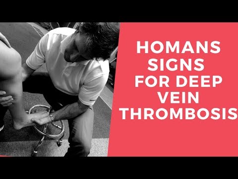 Homans Sign for Deep Vein Thrombosis