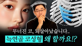 복코·구축코 재수술에 쓰이는 늑연골, 이 영상 하나로 다 정리해드립니다!| 자가늑연골의 모든 것 | 코슐랭tv 비더뉴