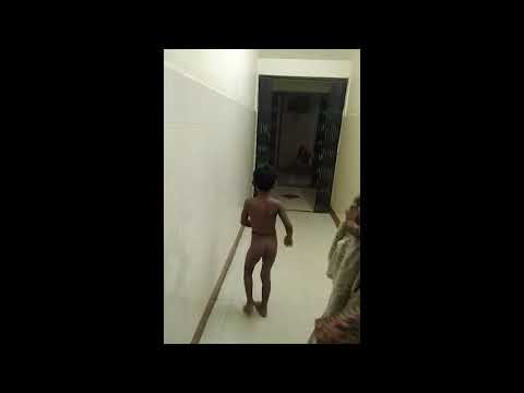 A Case Of Limping Child