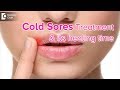 Best Medicine For Cold Sores And Fever Blisters