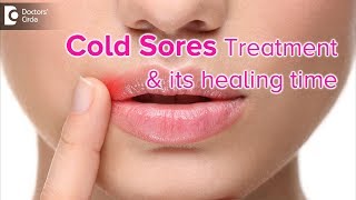 What is the best treatment for cold sores?How soon will it heal? - Dr. Rasya Dixit