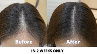 How to Stop Hair fall and grow hair faster- 3 Natural Hair remedies to try at home
