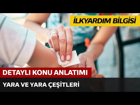 Yara ve Yara Çeşitleri Yara ve Yara Çeşitleri
