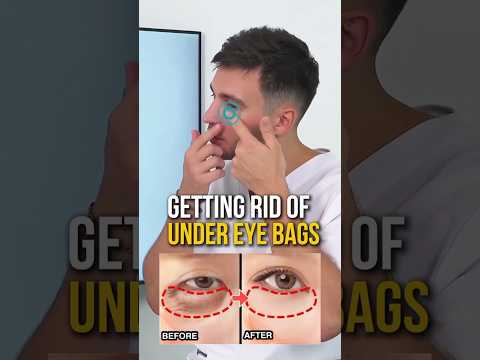 Removing UNDER EYE BAGS 🔥 #osteopathy #undereyebags #wrinkles #facefitness #faceyoga #skincare