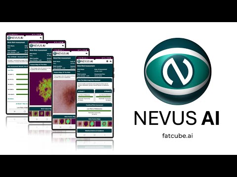 Nevus AI
