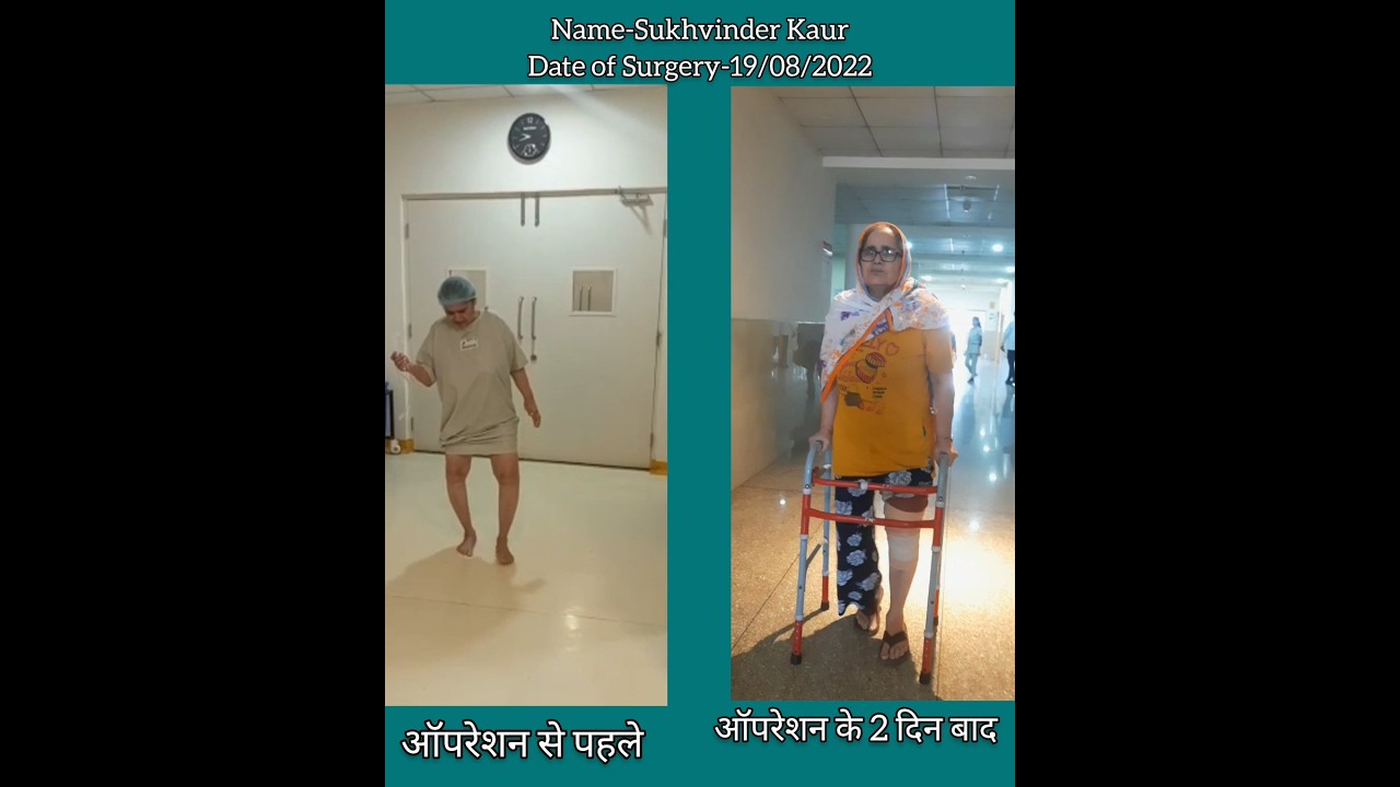 Knee Replacement Surgery - pt name Sukhvinder Kaur #kneepain #drtarunsolanki #kvrhospitalkashipur