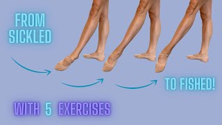 How to stop sickling with 5 easy exercises