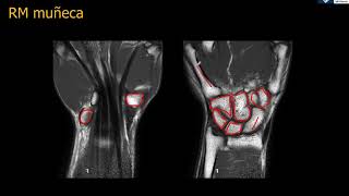 Anatomía RM muñeca