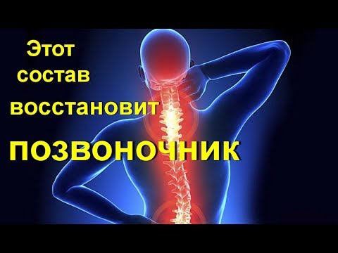 Боль слева внизу и у поясницы слева Упражнение при артрозе коленного сустава для пожилых