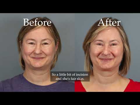 Leong Plastic Surgery NYC