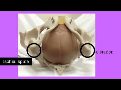 Topic 11: Intrapartum Care *