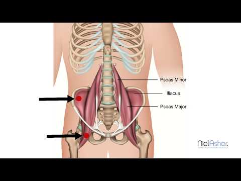 Psoas Muscles - How To Find Trigger Points (Back and Groin Pain)
