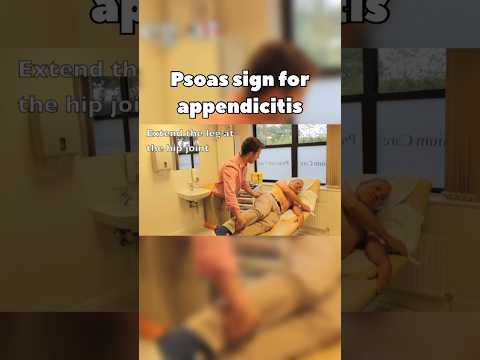 Psoas Sign for Appendicitis