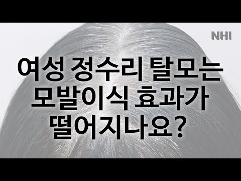 [탈모치료][모발이식]여자 정수리 탈모는 모발이식 효과가 떨어지나요?ㅣ뉴헤어