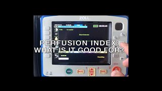 Perfusion Index: what is it good for Absolutely something!