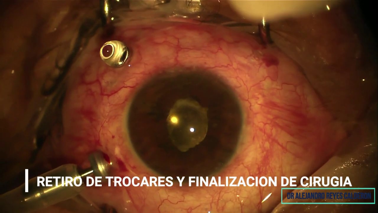 Jesús Alejandro Reyes Calderón-8