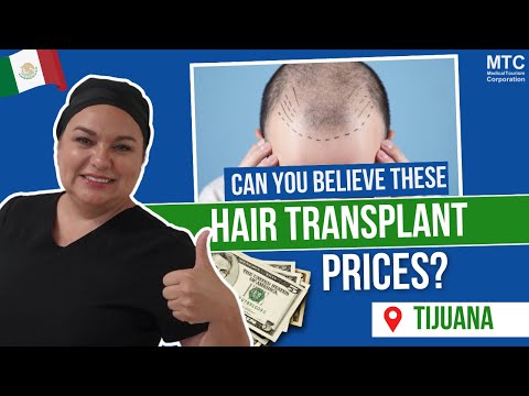 Why This Top Hair Transplant Clinic in Tijuana, Mexico Shines: Honesty, Technology, & Affordability!